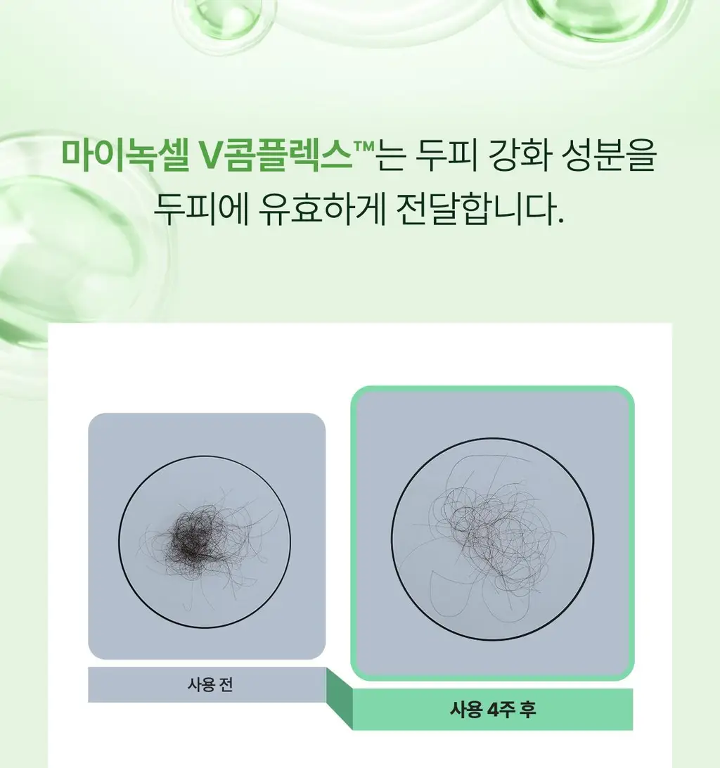 [허경환 PICK/현대약품특허]마이녹셀 포어클렌징 스칼프 샴푸 480ml 상세페이지 24